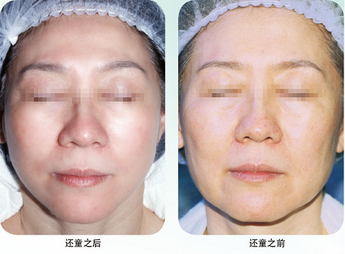 腾博会官网 - 诚信为本,专业效劳!