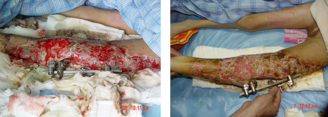 腾博会官网 - 诚信为本,专业效劳!