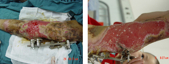 腾博会官网 - 诚信为本,专业效劳!