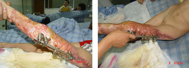 腾博会官网 - 诚信为本,专业效劳!