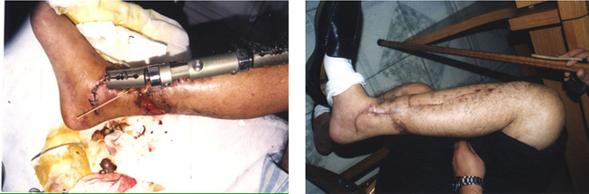 腾博会官网 - 诚信为本,专业效劳!