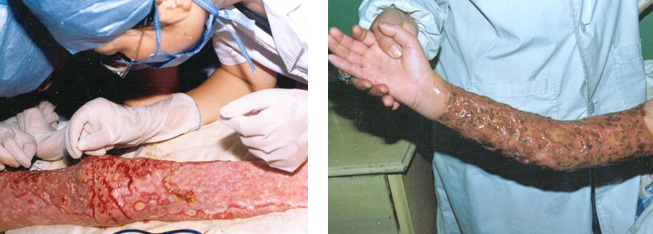 腾博会官网 - 诚信为本,专业效劳!