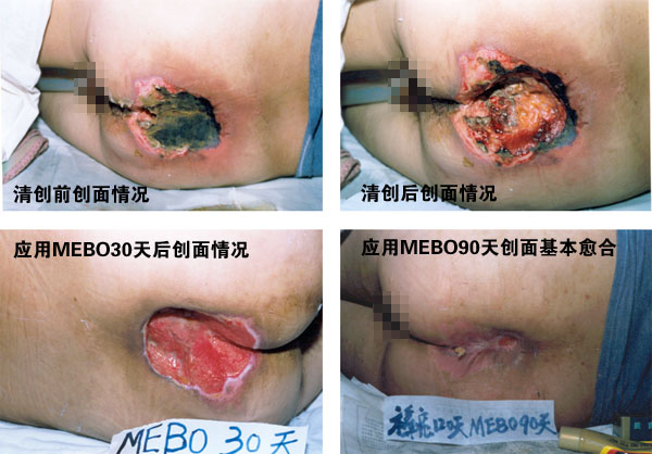 腾博会官网 - 诚信为本,专业效劳!