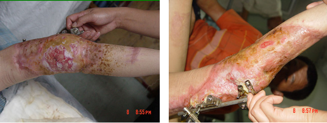 腾博会官网 - 诚信为本,专业效劳!