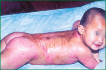 腾博会官网 - 诚信为本,专业效劳!