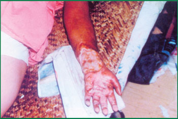 腾博会官网 - 诚信为本,专业效劳!