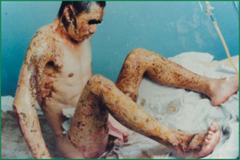 腾博会官网 - 诚信为本,专业效劳!