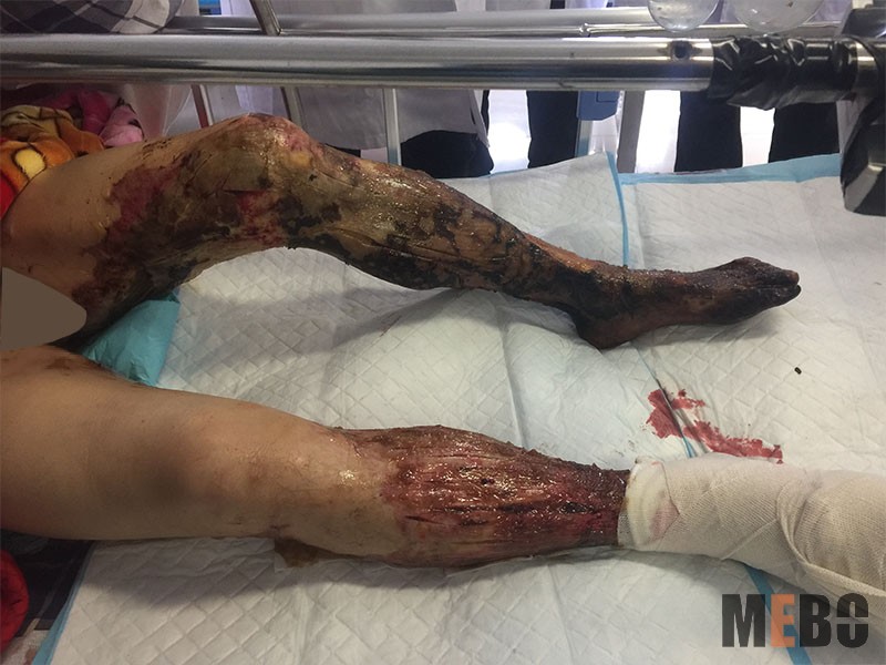 腾博会官网 - 诚信为本,专业效劳!