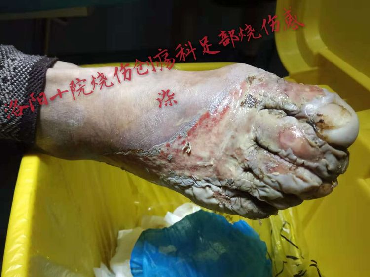 腾博会官网 - 诚信为本,专业效劳!