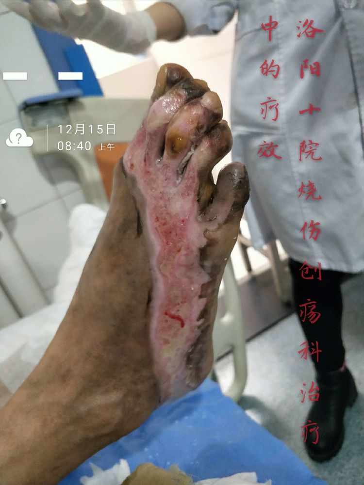 腾博会官网 - 诚信为本,专业效劳!