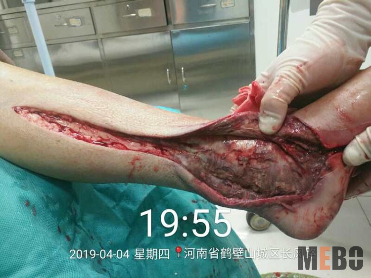 腾博会官网 - 诚信为本,专业效劳!