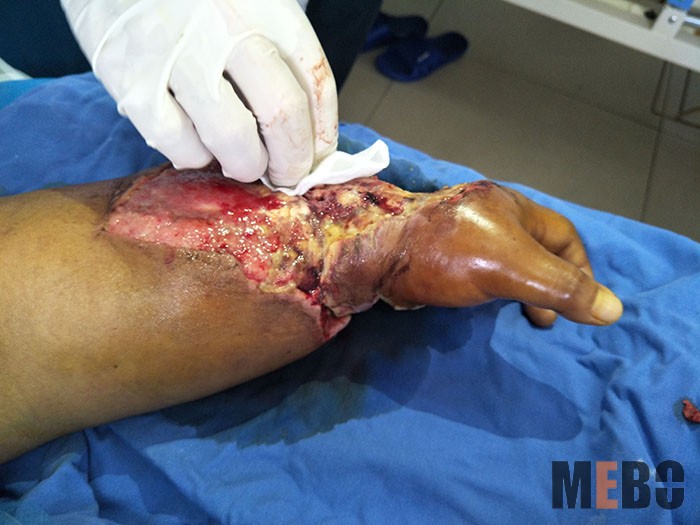 腾博会官网 - 诚信为本,专业效劳!