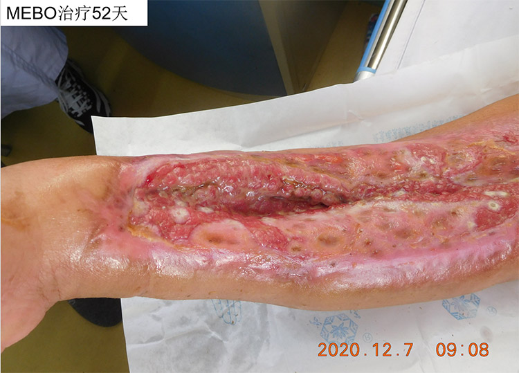 腾博会官网 - 诚信为本,专业效劳!