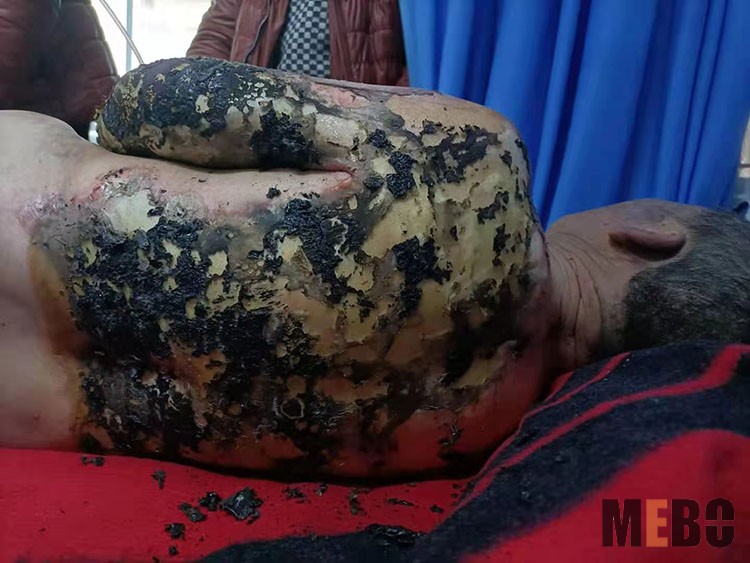 腾博会官网 - 诚信为本,专业效劳!