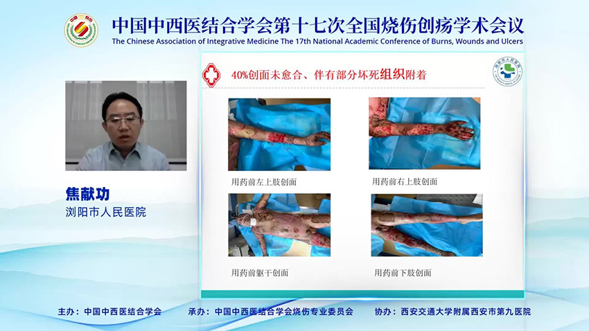 腾博会官网 - 诚信为本,专业效劳!