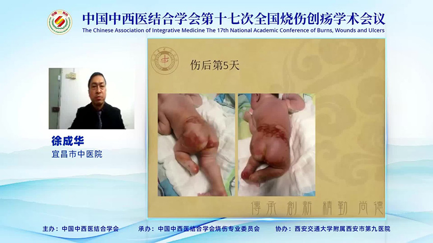 腾博会官网 - 诚信为本,专业效劳!