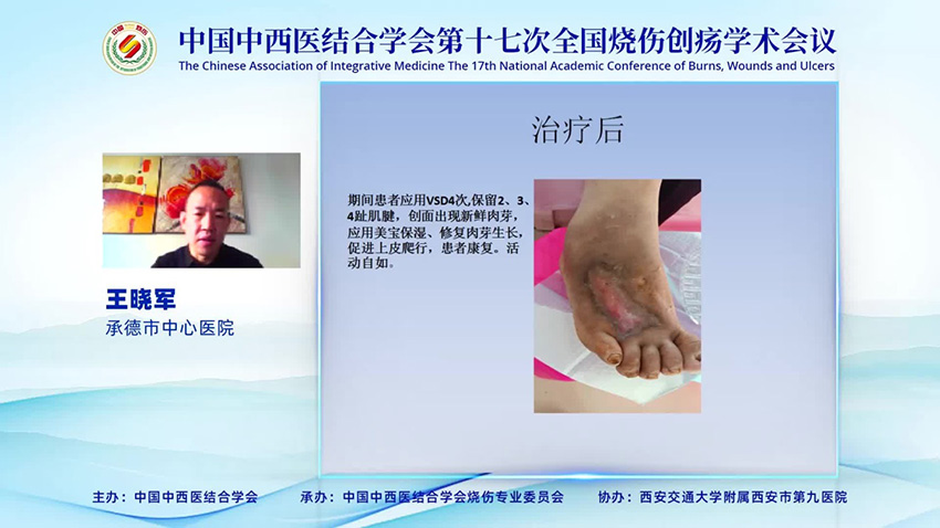 腾博会官网 - 诚信为本,专业效劳!