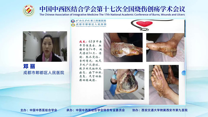 腾博会官网 - 诚信为本,专业效劳!