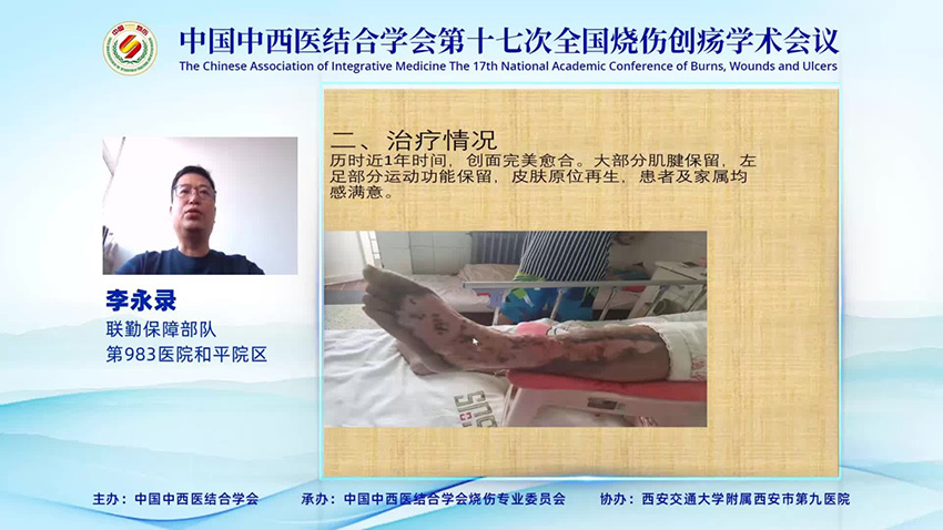 腾博会官网 - 诚信为本,专业效劳!