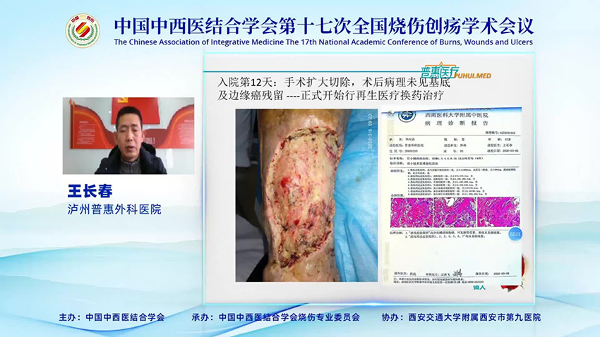 腾博会官网 - 诚信为本,专业效劳!