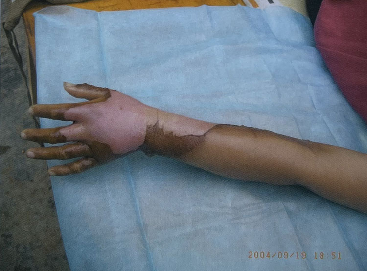 腾博会官网 - 诚信为本,专业效劳!