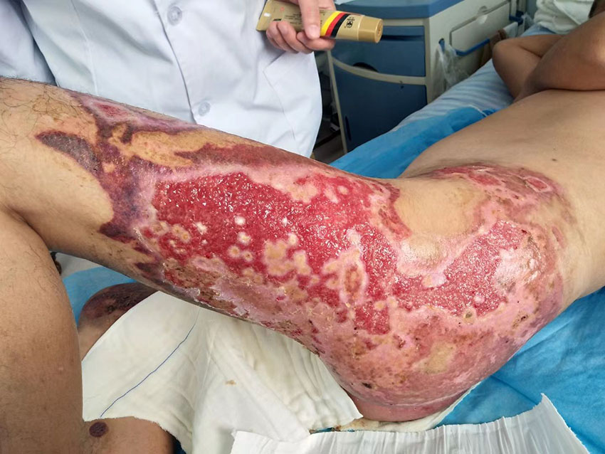 腾博会官网 - 诚信为本,专业效劳!