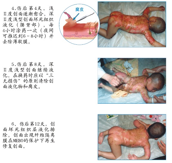 腾博会官网 - 诚信为本,专业效劳!
