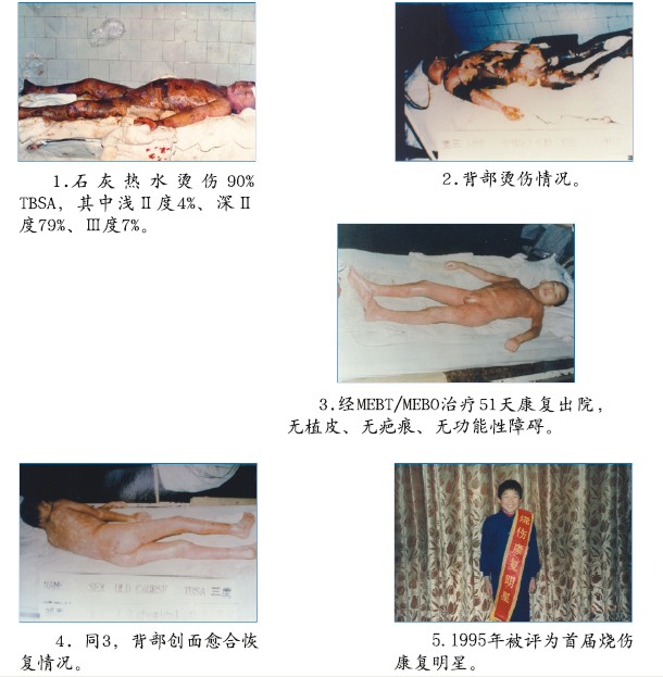 腾博会官网 - 诚信为本,专业效劳!