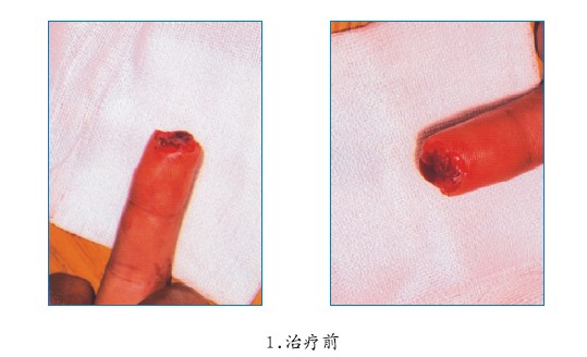 腾博会官网 - 诚信为本,专业效劳!