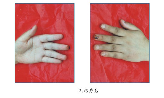 腾博会官网 - 诚信为本,专业效劳!