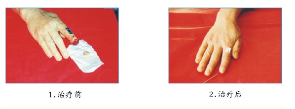 腾博会官网 - 诚信为本,专业效劳!