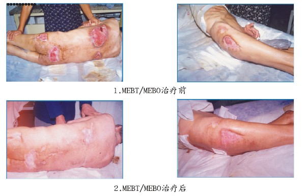 腾博会官网 - 诚信为本,专业效劳!