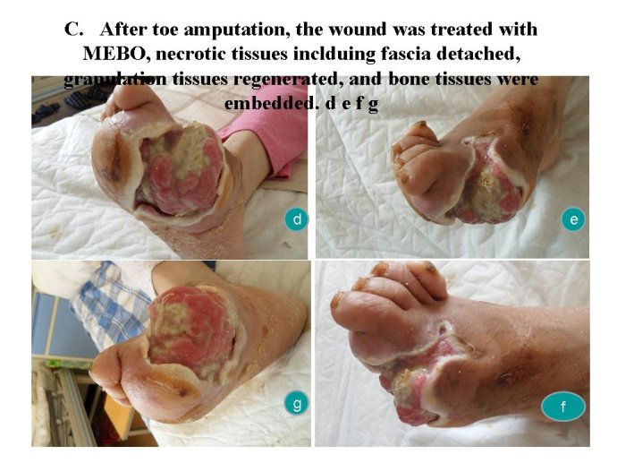 腾博会官网 - 诚信为本,专业效劳!