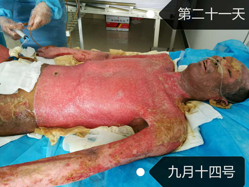 腾博会官网 - 诚信为本,专业效劳!