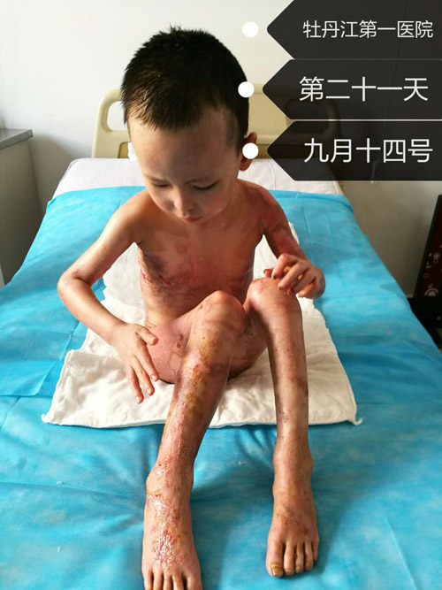 腾博会官网 - 诚信为本,专业效劳!